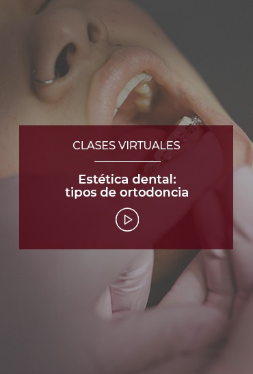 estetica-dental-tipos-de-ortodoncia